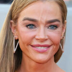 Denise Richards’ $200K Facelift Sparks Shock and Wild Speculation—You Won’t Believe Her Stunning Transformation!