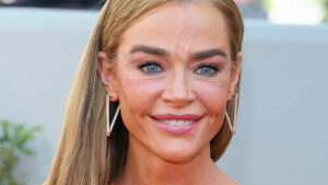 Denise Richards’ $200K Facelift Sparks Shock and Wild Speculation—You Won’t Believe Her Stunning Transformation!