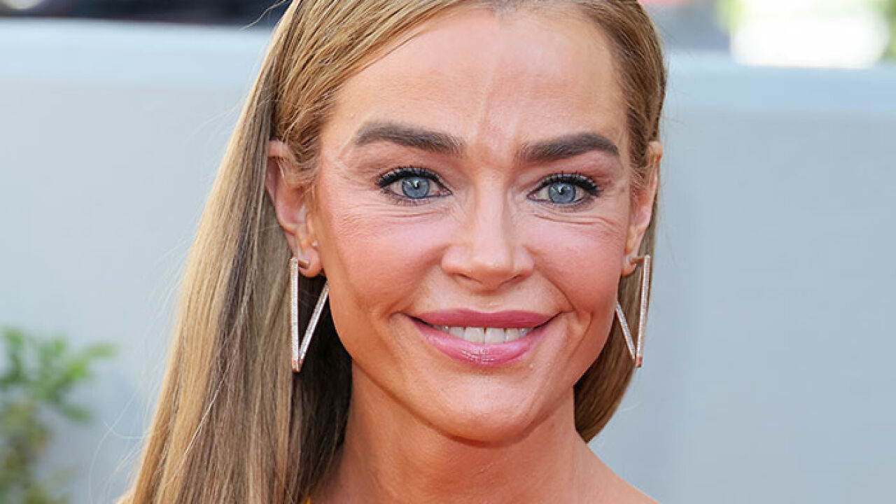 Denise Richards’ $200K Facelift Sparks Shock and Wild Speculation—You Won’t Believe Her Stunning Transformation!