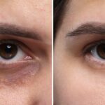 Is Your Reflection Trying to Tell You Something? The Hidden 'Ferritin Face' Trend Going Viral