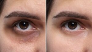 Is Your Reflection Trying to Tell You Something? The Hidden 'Ferritin Face' Trend Going Viral