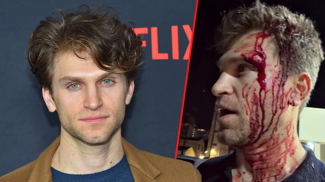 'Pretty Little Liars' Star Keegan Allen's Harrowing Encounter: What Really Happened During West Hollywood's Alarming Robbery?